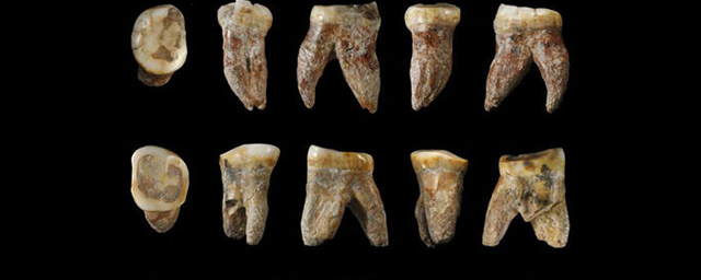 В стене в США обнаружили замурованные зубы человека